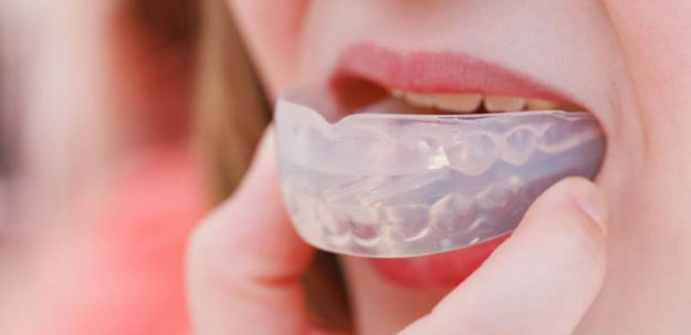 Protetor Bucal: conheça os tipos que existem.