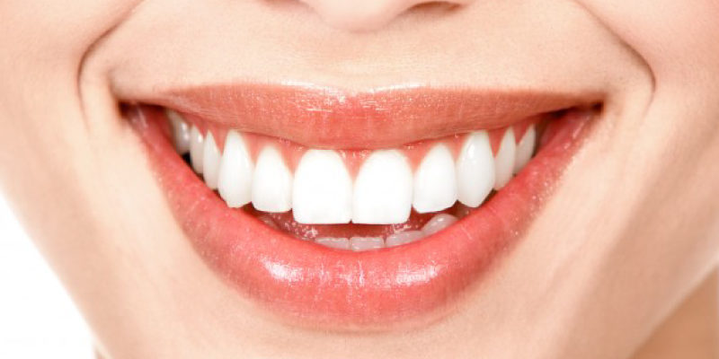 rettore-sorriso-bonito Sorriso bonito: entenda o que você precisa para ter.