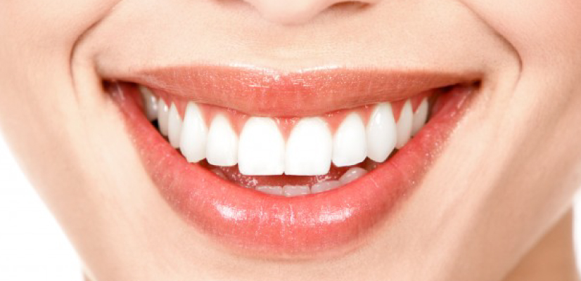 Sorriso bonito: entenda o que você precisa para ter.