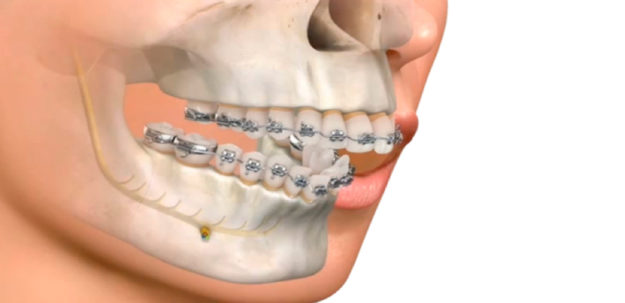 Traumatologia Bucomaxilofacial: entenda melhor sobre esse ramo da odontologia